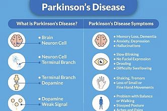 Parkinson's Disease Dementia