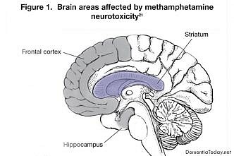 Micro-map of hippocampus lends big hand to brain research