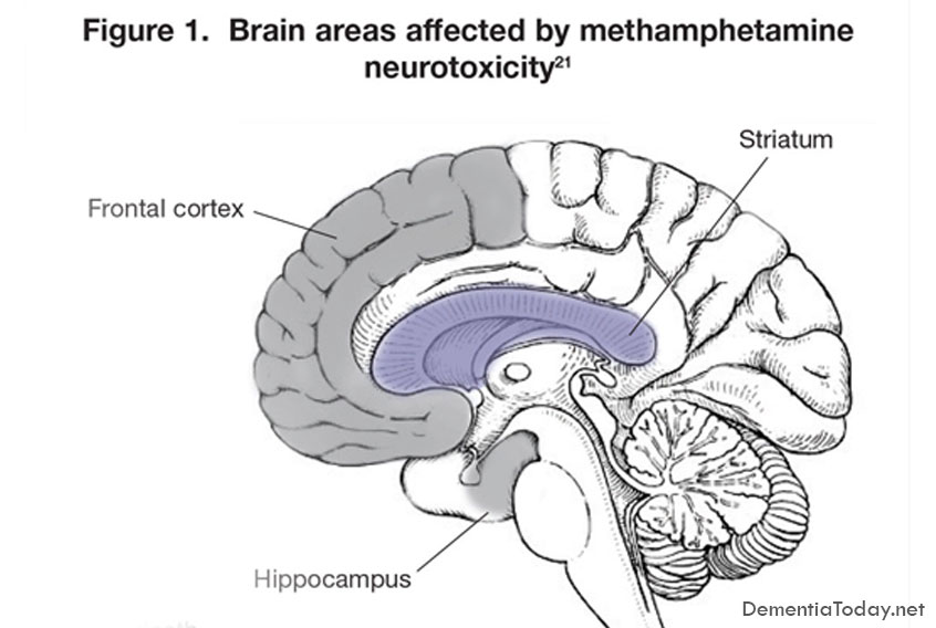 Micro-map of hippocampus lends big hand to brain research
